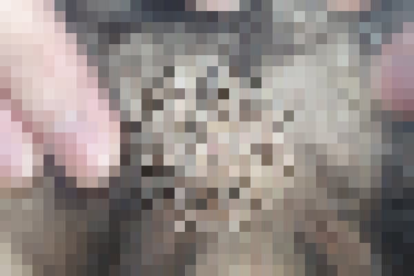 곤지름 치료 전 사진 — 천안아산점, 기타, 20대 남, 치료 기간 3개월 치료전 (모자이크 처리)