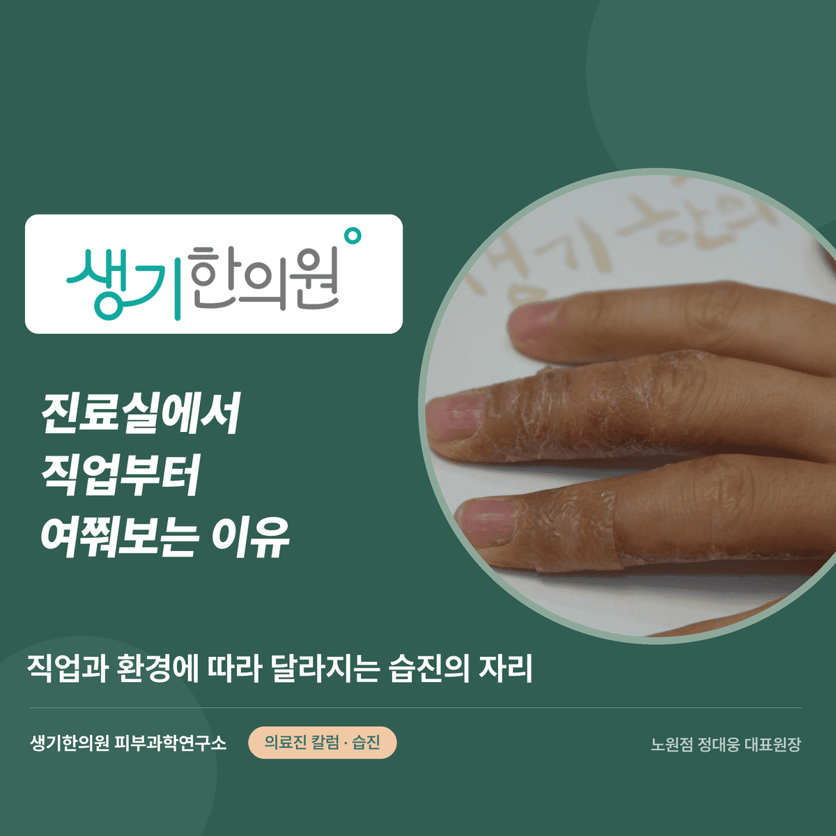 진료실에서 직업부터 여쭤보는 이유 — 직업과 환경에 따라 달라지는 습진의 자리 대표 이미지