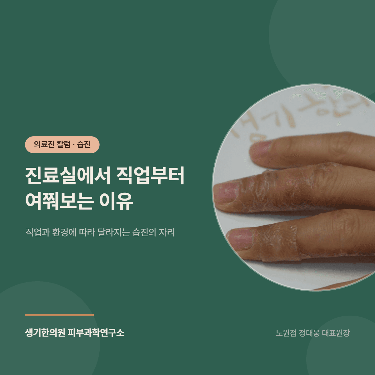 진료실에서 직업부터 여쭤보는 이유 — 직업과 환경에 따라 달라지는 습진의 자리 대표 이미지