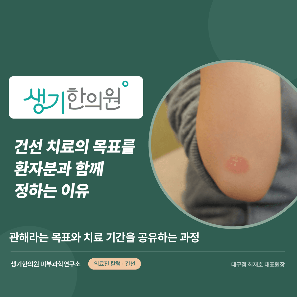 건선 치료의 목표를 환자분과 함께 정하는 이유 — 관해와 치료 기간을 공유하는 과정 대표 이미지