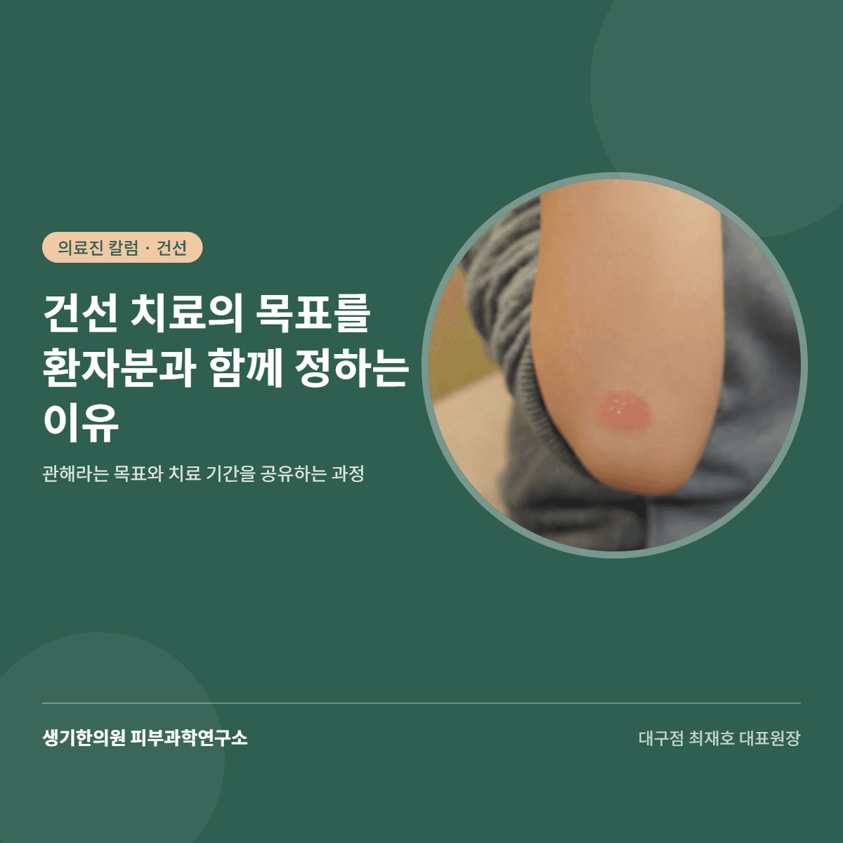 건선 치료의 목표를 환자분과 함께 정하는 이유 — 관해와 치료 기간을 공유하는 과정 대표 이미지
