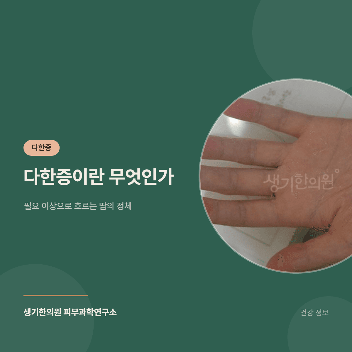 다한증이란 무엇인가 — 필요 이상으로 흐르는 땀의 정체 대표 이미지