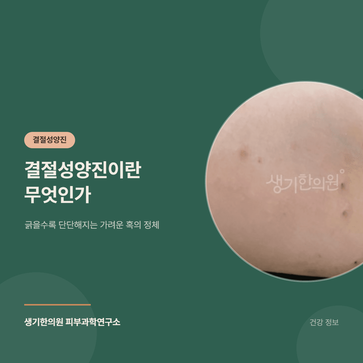 결절성양진이란 무엇인가 — 긁을수록 단단해지는 가려운 혹의 정체 대표 이미지