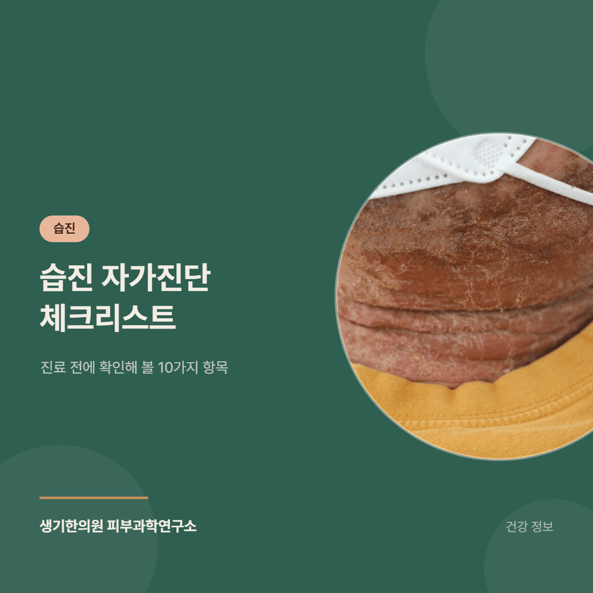 습진 자가진단 체크리스트 — 진료 전에 확인해 볼 10가지 항목 대표 이미지