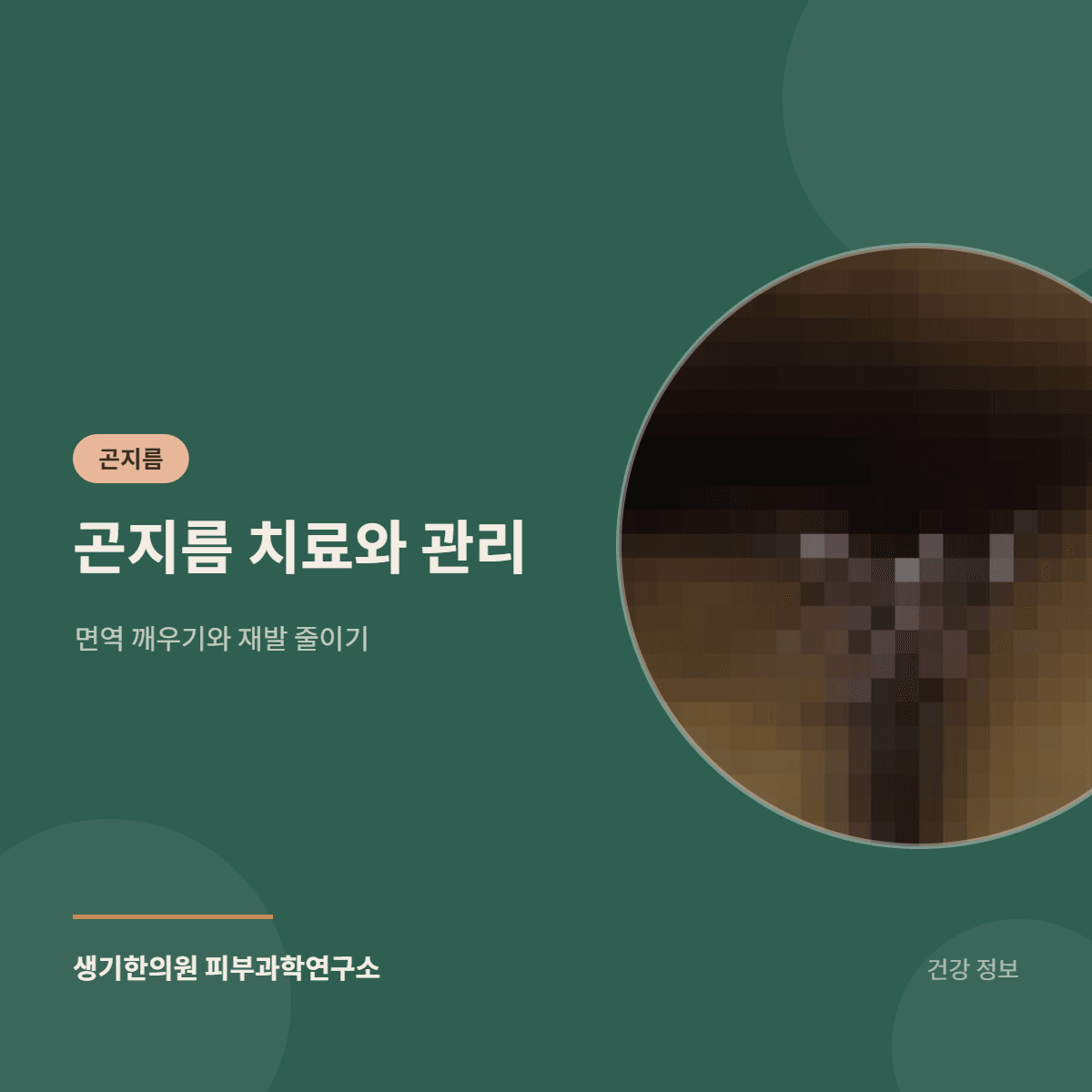 곤지름 치료와 관리 — 면역 깨우기와 재발 줄이기 대표 이미지