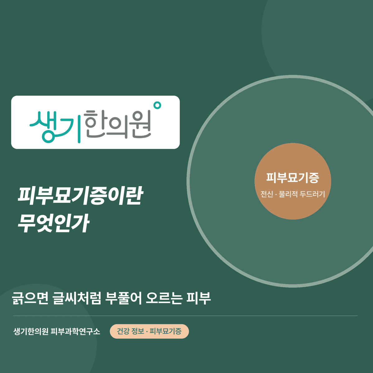 피부묘기증이란 무엇인가 — 긁으면 글씨처럼 부풀어 오르는 피부 대표 이미지
