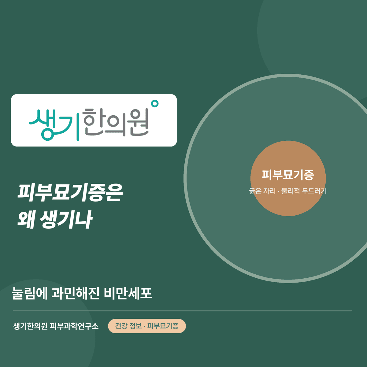 피부묘기증은 왜 생기나 — 눌림에 과민해진 비만세포 대표 이미지