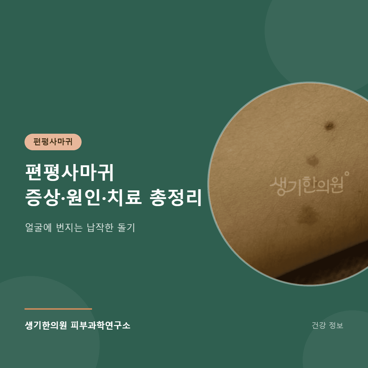 편평사마귀 증상·원인·치료 총정리 대표 이미지