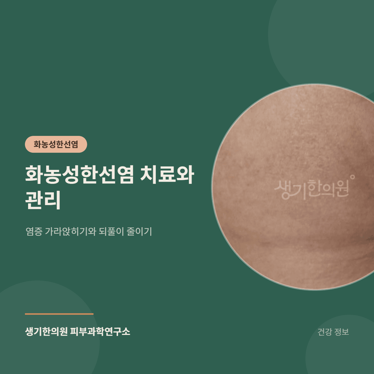 화농성한선염 치료와 관리 — 염증 가라앉히기와 되풀이 줄이기 대표 이미지