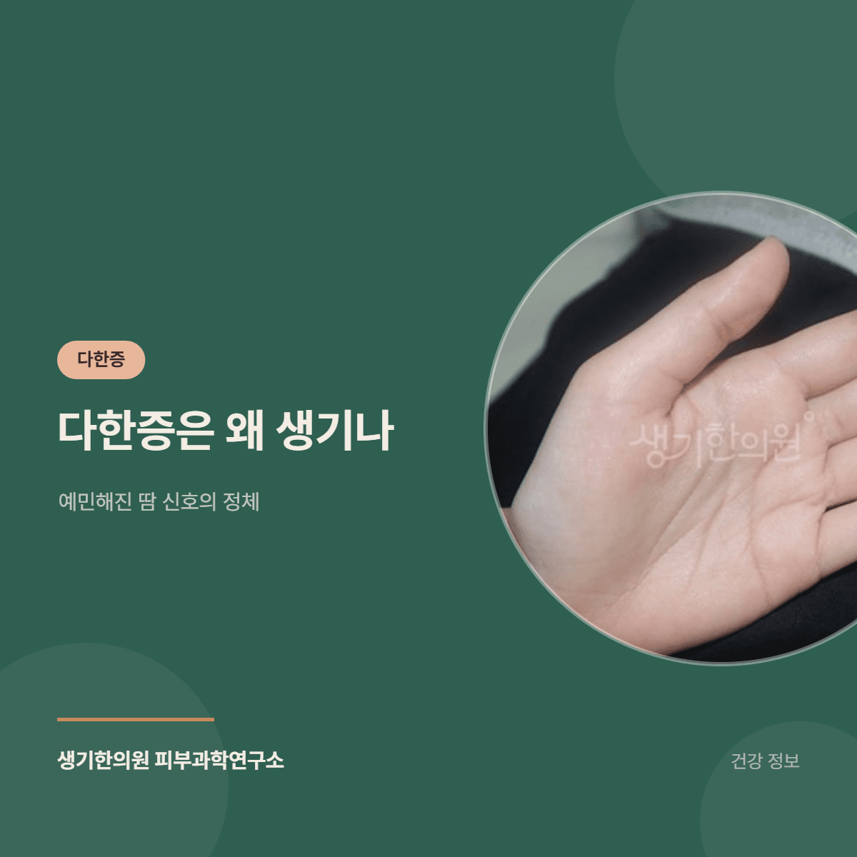 다한증은 왜 생기나 — 예민해진 땀 신호의 정체 대표 이미지