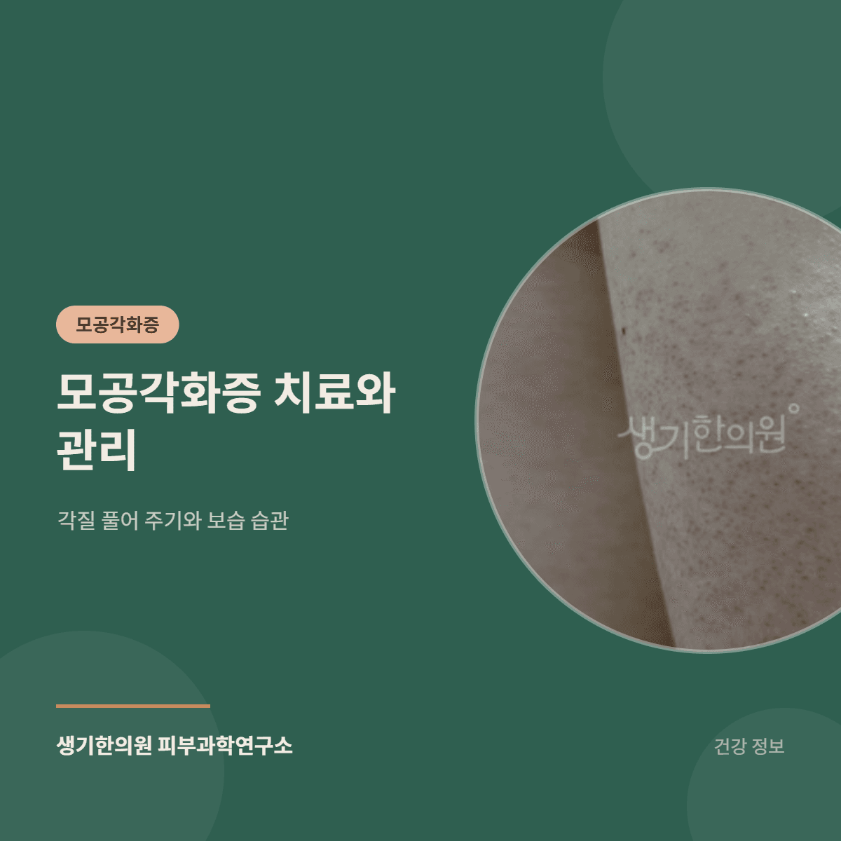 모공각화증 치료와 관리 — 각질 풀어 주기와 보습 습관 대표 이미지