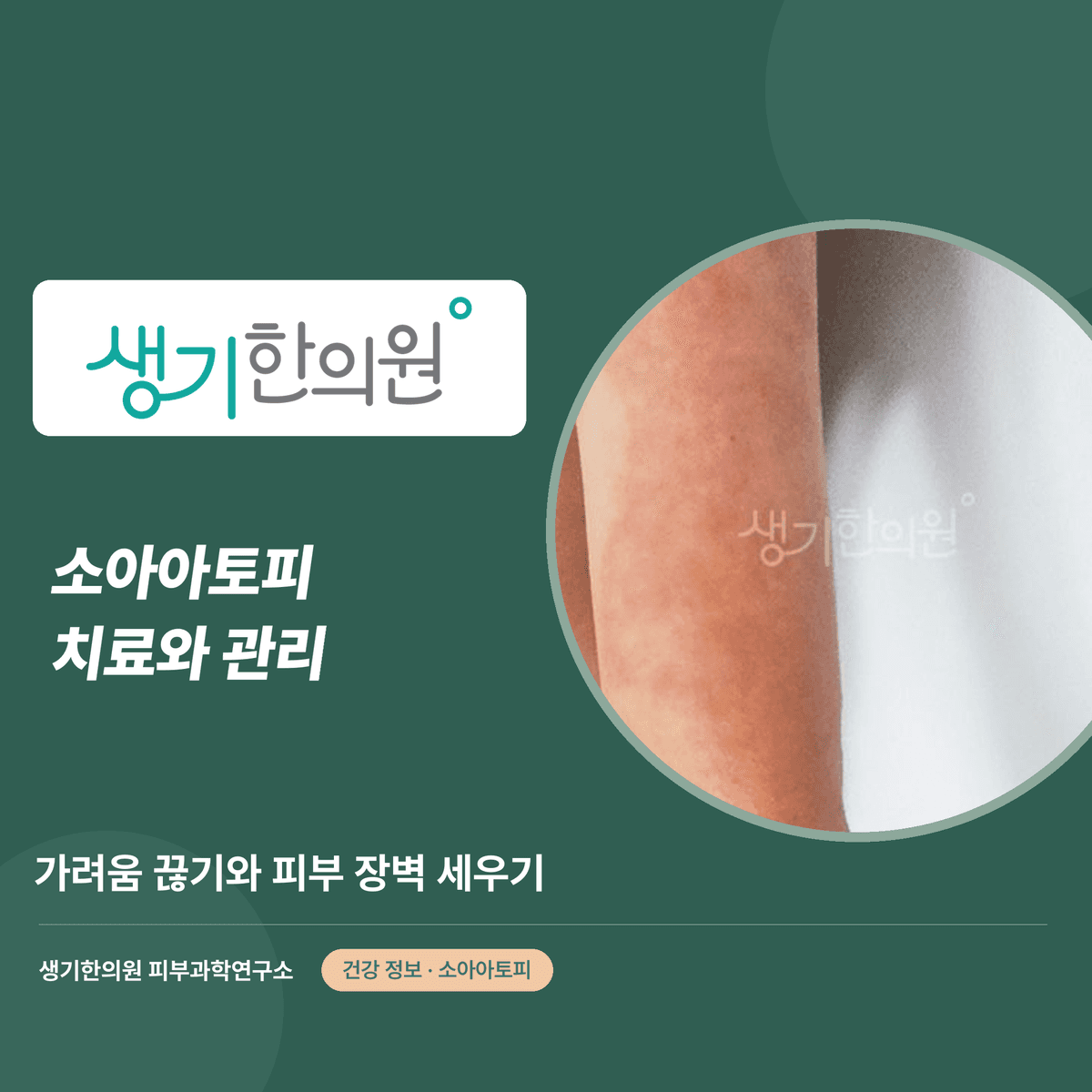 소아아토피 치료와 관리 — 가려움 끊기와 피부 장벽 세우기 대표 이미지