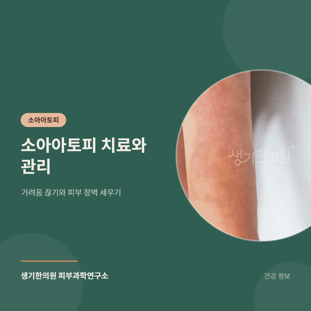 소아아토피 치료와 관리 — 가려움 끊기와 피부 장벽 세우기 대표 이미지
