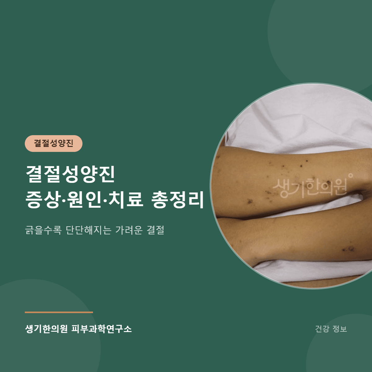 결절성양진 증상·원인·치료 총정리 대표 이미지