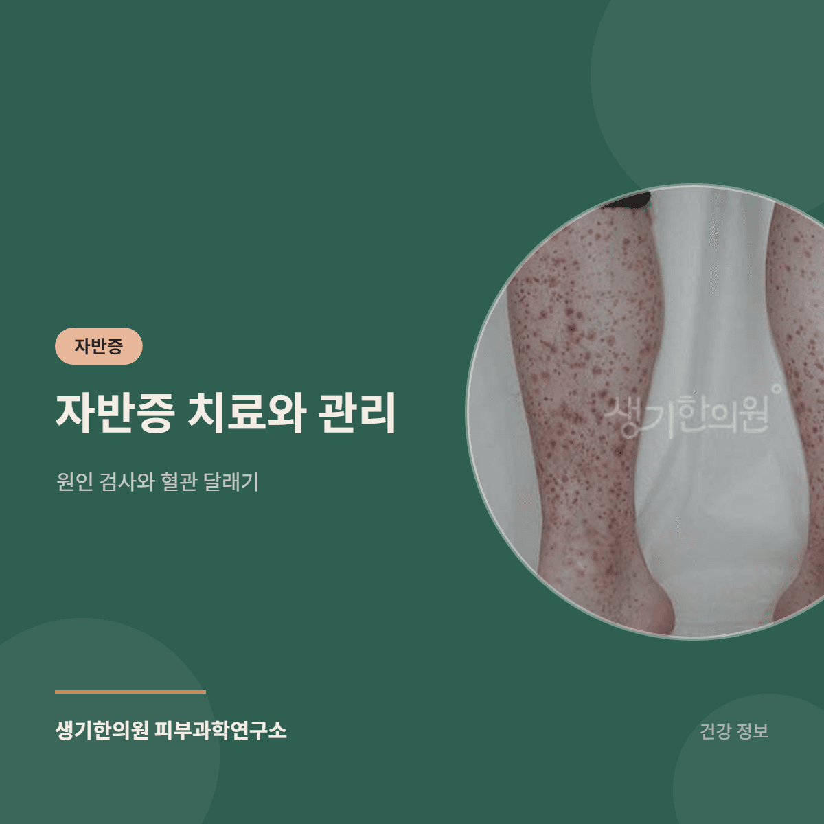 자반증 치료와 관리 — 원인 검사와 혈관 달래기 대표 이미지