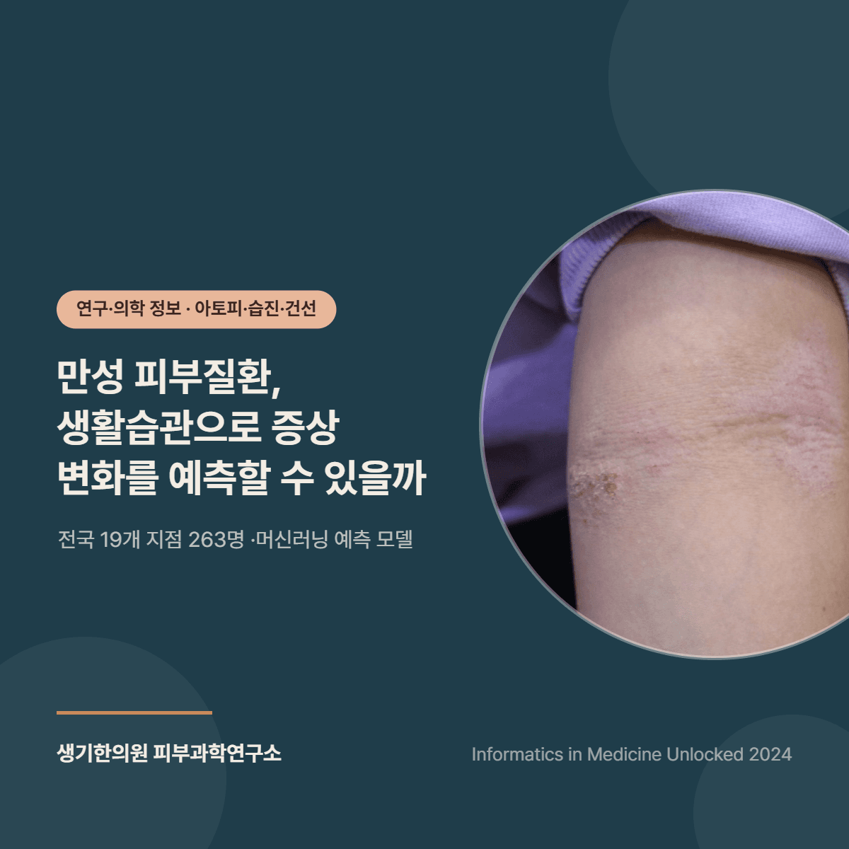 만성 피부질환 생활습관 증상 변화 예측 머신러닝 모델 연구 소개 대표 이미지