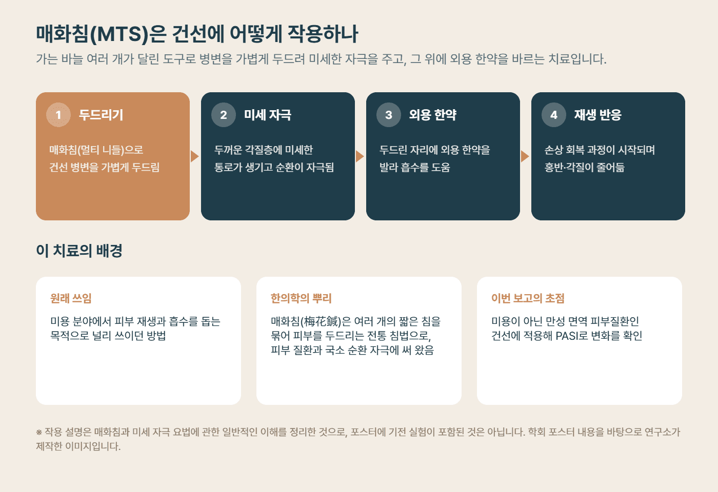 매화침(MTS) 건선 치료의 방법과 배경 도해