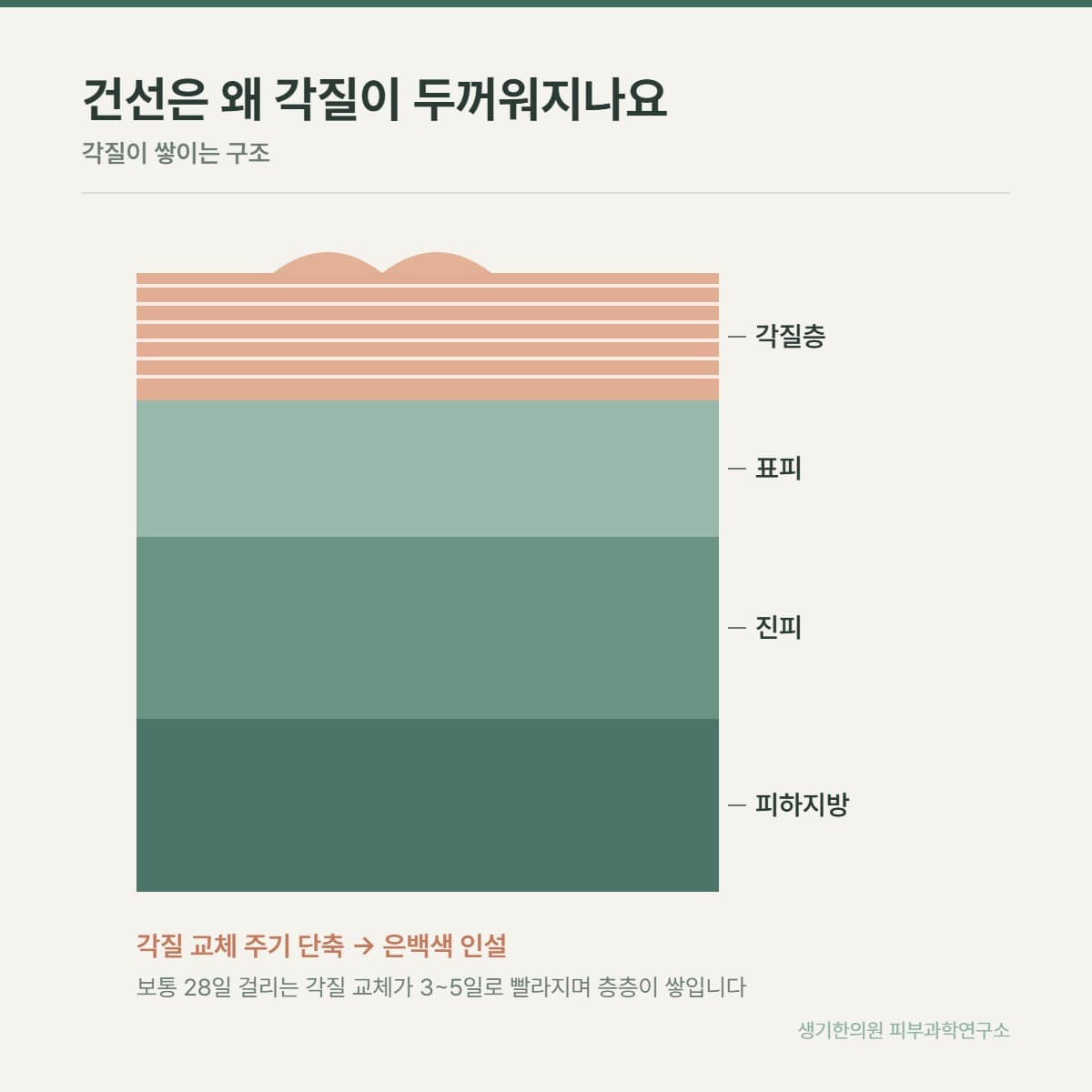 건선 발생 구조 안내 그림