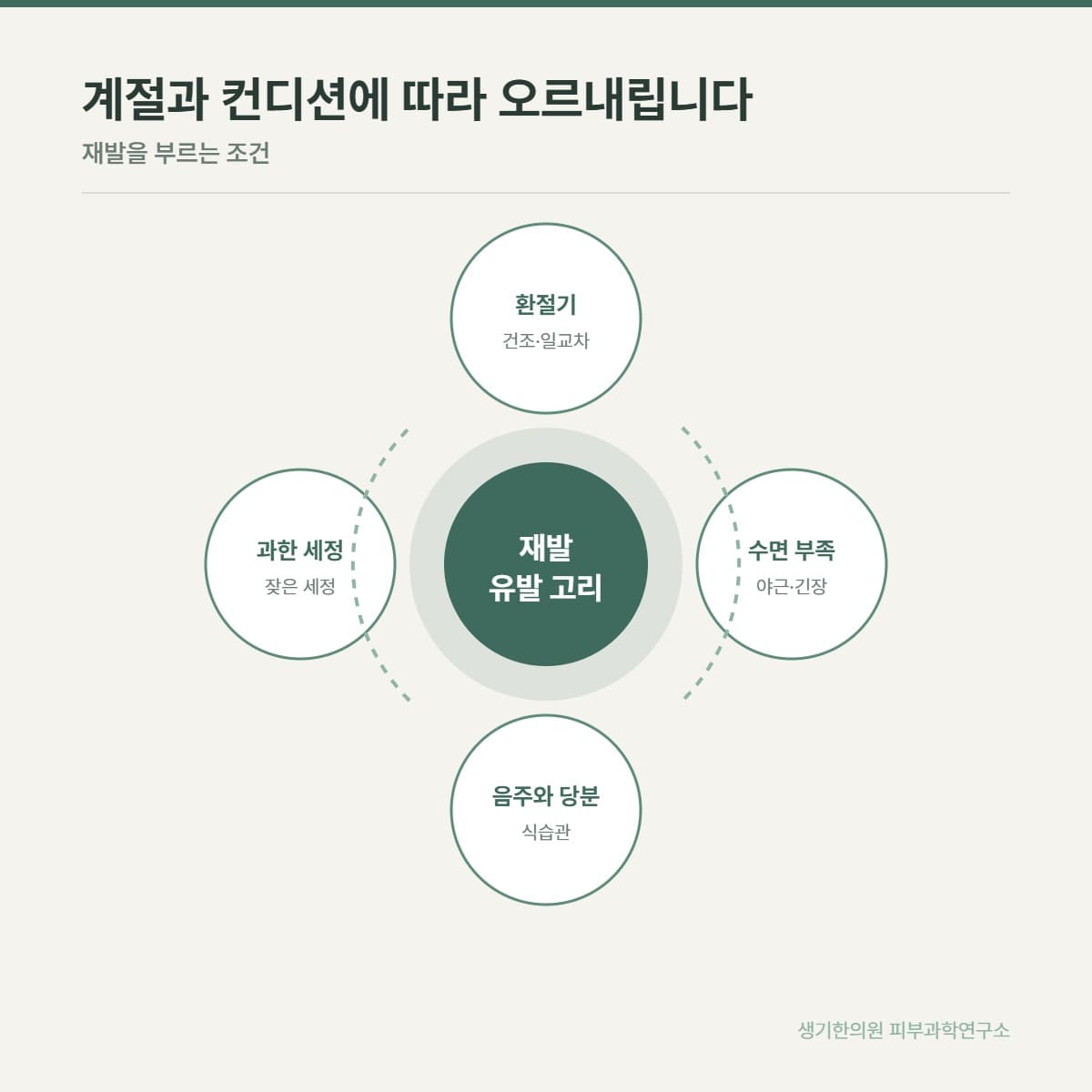 지루성피부염 재발 요인 안내 그림