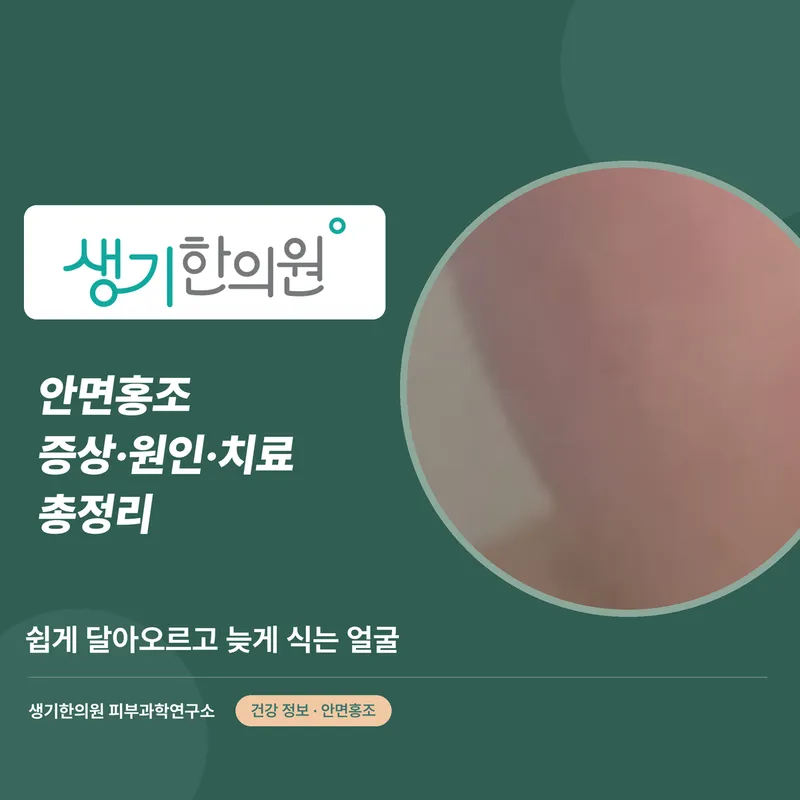 안면홍조 증상·원인·치료 총정리 대표 이미지