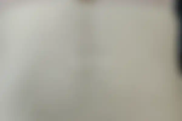 편평사마귀 치료 후 사진 — 대전점, 치료 기간 5개월