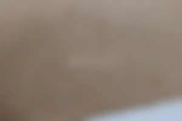 편평사마귀 치료 후 사진 — 부천점, 치료 기간 7개월