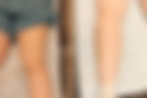 두드러기 치료 후 사진 — 부산센텀점, 치료 기간 3개월