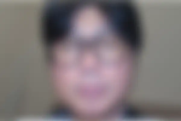 안면홍조 치료 후 사진 — 천안아산점, 치료 기간 4개월