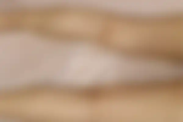 두드러기 치료 후 사진 — 분당점, 치료 기간 3개월