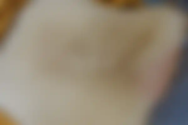 건선 치료 후 사진 — 일산점, 치료 기간 8개월