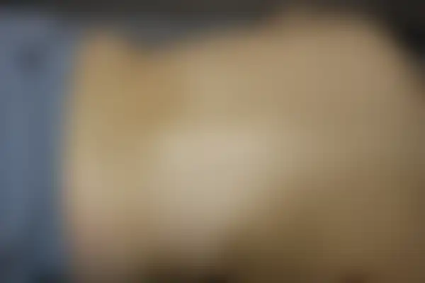 건선 치료 후 사진 — 수원점, 치료 기간 2개월