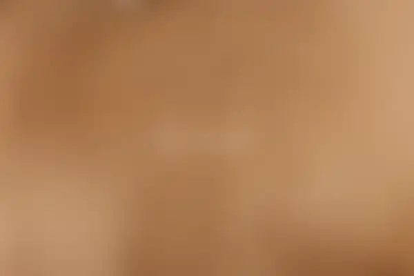 건선 치료 후 사진 — 분당점, 치료 기간 2개월