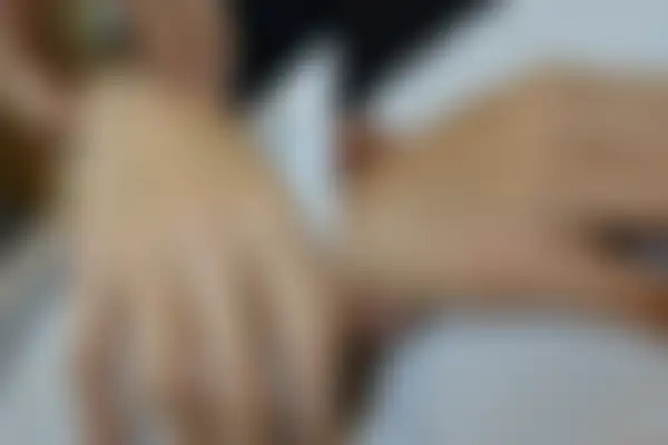 한포진 치료 후 사진 — 일산점, 치료 기간 8개월