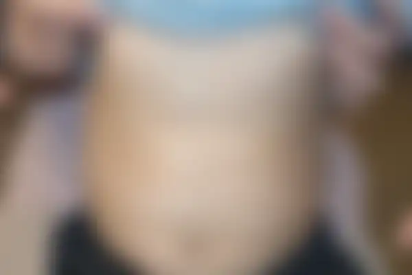 소아아토피 치료 후 사진 — 천안아산점, 치료 기간 3개월