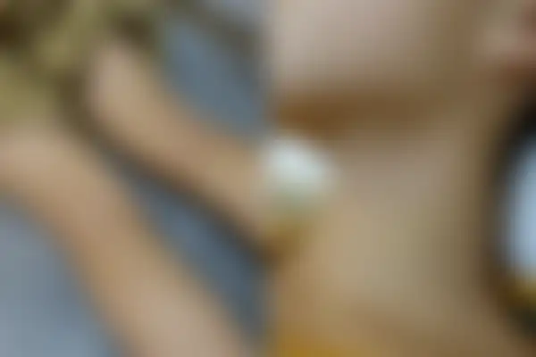 아토피 치료 후 사진 — 일산점, 치료 기간 6개월