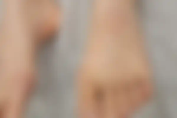 습진 치료 후 사진 — 마포공덕점, 치료 기간 8개월