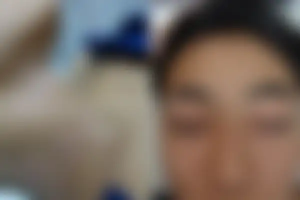 소아아토피 치료 후 사진 — 광주점, 치료 기간 5개월