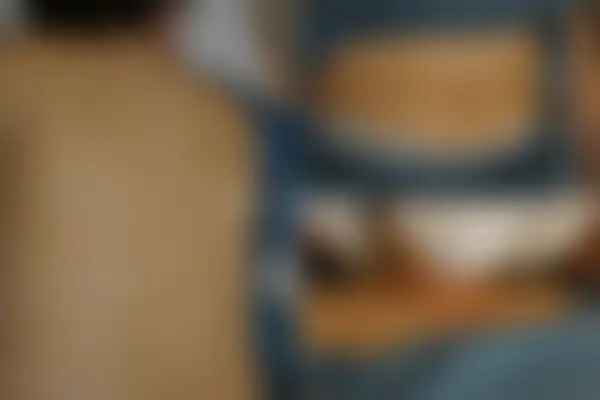 습진 치료 후 사진 — 부산센텀점, 치료 기간 7개월