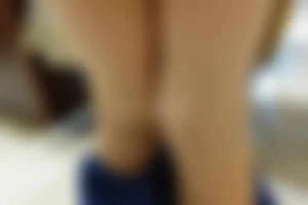 소아아토피 치료 후 사진 — 광주점, 치료 기간 3개월
