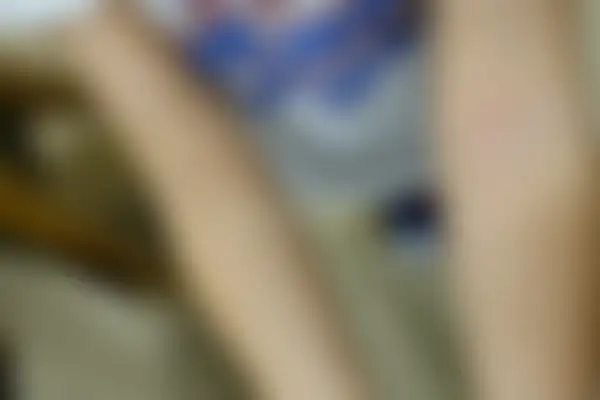 소아아토피 치료 후 사진 — 광주점, 치료 기간 6개월
