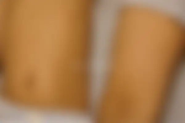 소아아토피 치료 후 사진 — 부산센텀점, 치료 기간 6개월