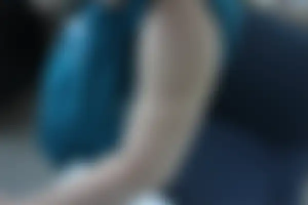 소아아토피 치료 후 사진 — 부산서면점, 치료 기간 5개월