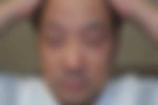 아토피 치료 후 사진 — 천안아산점, 치료 기간 3개월
