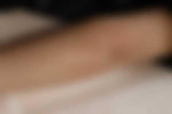 아토피 치료 후 사진 — 분당점, 치료 기간 9개월