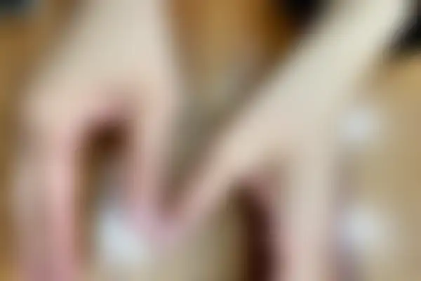 아토피 치료 후 사진 — 잠실점, 치료 기간 6개월