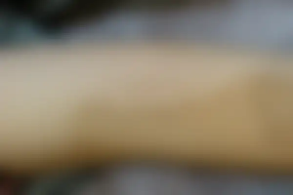 아토피 치료 후 사진 — 노원점, 치료 기간 6개월